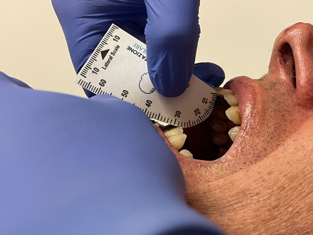 Fisioterapia dopo Chirurgia dell’Articolazione Temporo-Mandibolare (ATM): Recupero della Funzione Mandibolare 1 Fisioterapia dopo Chirurgia dell’Articolazione Temporo-Mandibolare (ATM): Recupero della Funzione Mandibolare